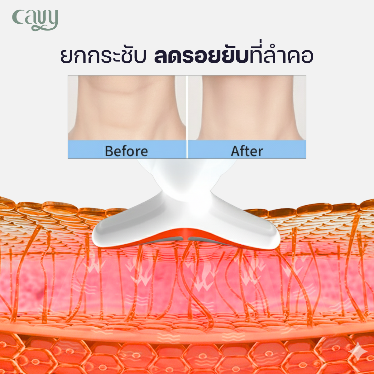 New 2026 CAVY Face & Neck Lifting