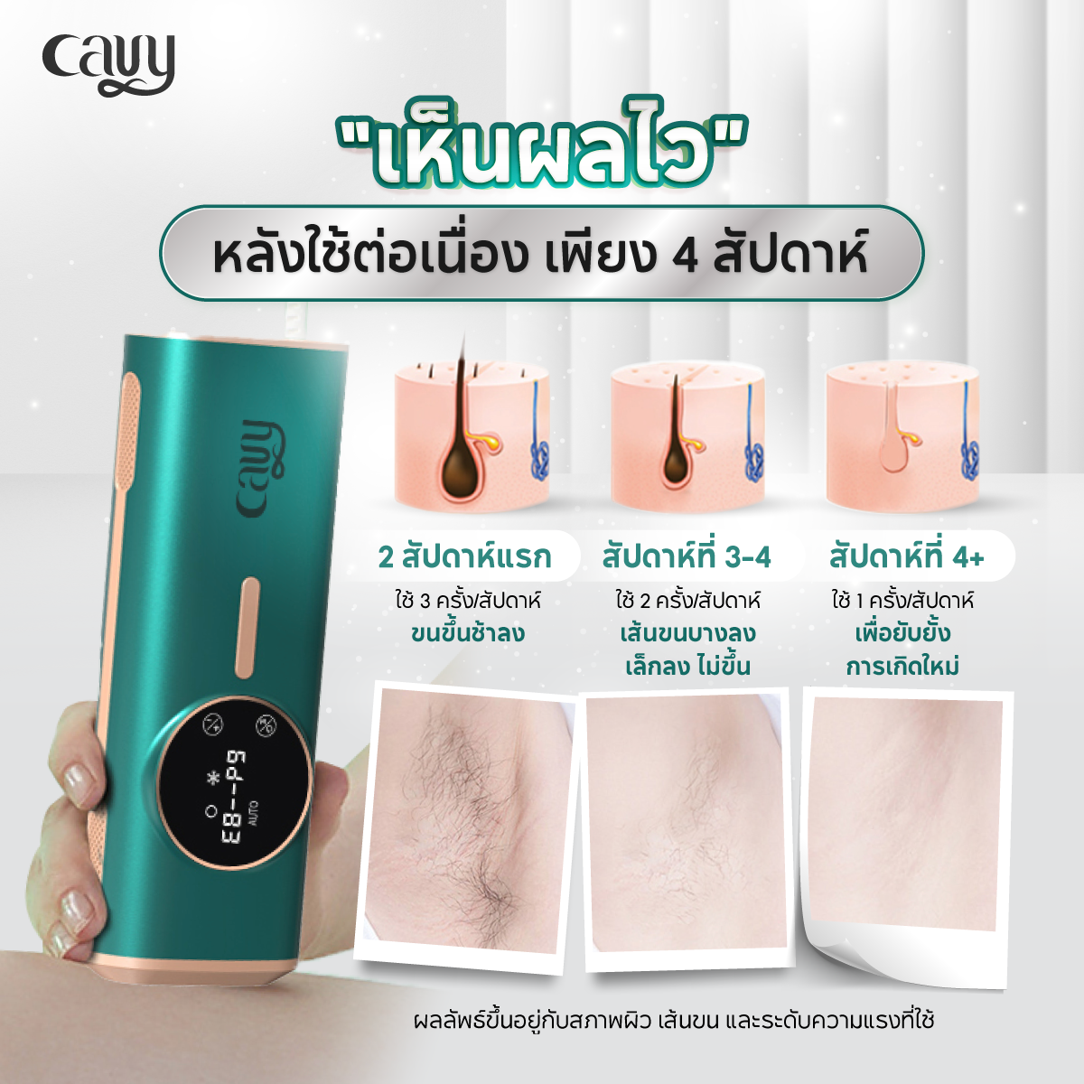 CAVY Sapphire IPL