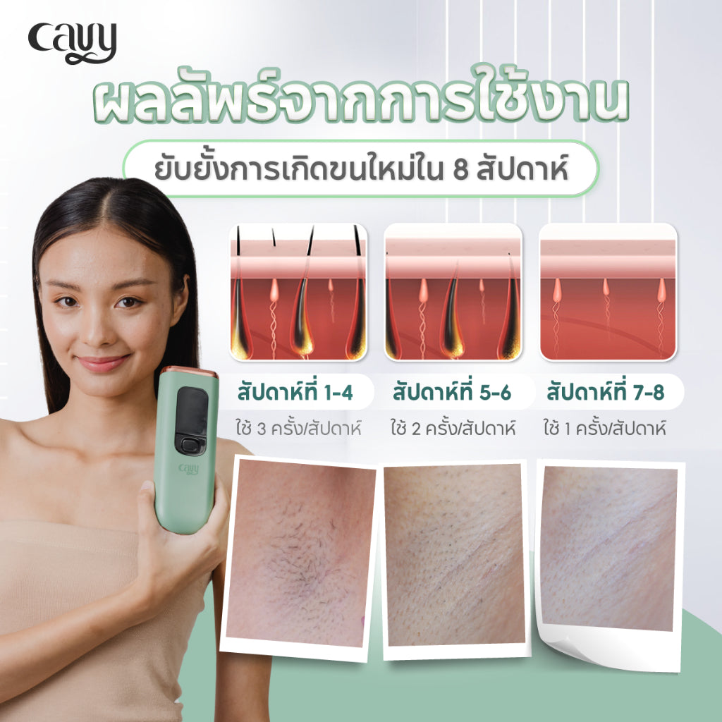 CAVY BIG SET C  : เซ็ตปรนนิบัติผิวใส ใช้ได้แบบรูทีน 8 ชิ้น - ประกัน 1 ปี