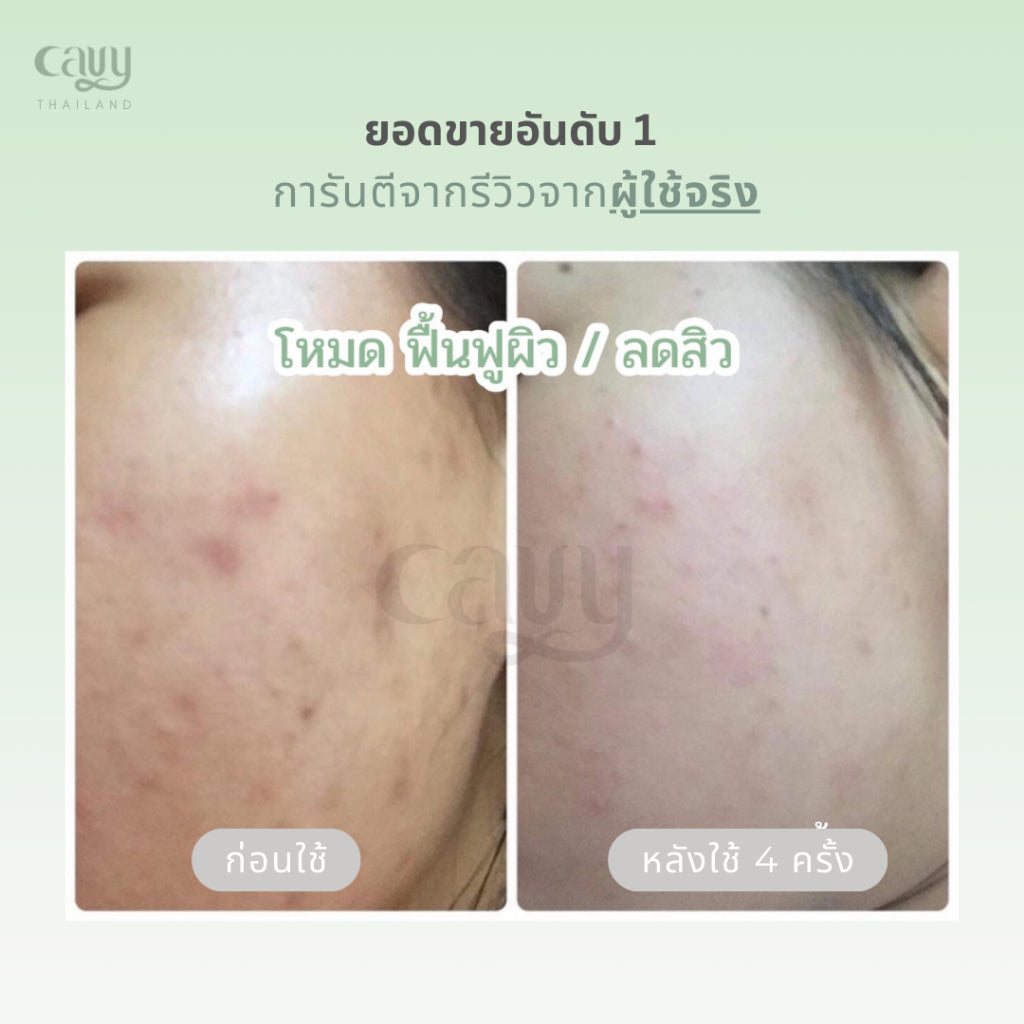 CAVY BIG SET C  : เซ็ตปรนนิบัติผิวใส ใช้ได้แบบรูทีน 8 ชิ้น - ประกัน 1 ปี